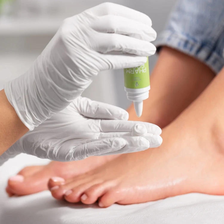 Wyciskanie olejku oxyZONE OIL 15 ml na dłoń w rękawiczce przed aplikacją na stopę